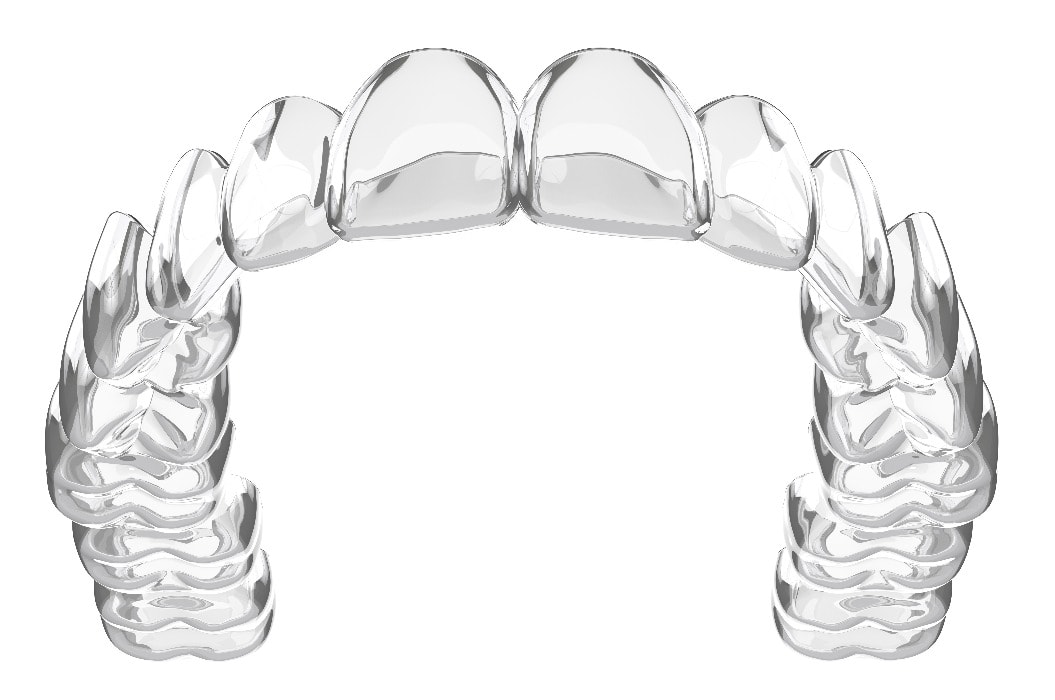 3d-Rendering der herausnehmbaren und unsichtbaren Zahnspange von invisalign