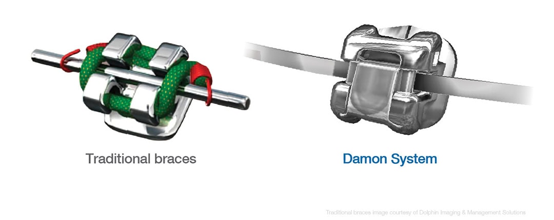 Twin vs Damon Rendering